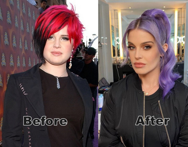 Kelly Osbourne Before and After Weight Loss
