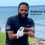 Anthony Anderson Weight Loss Surgery