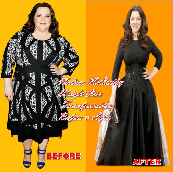 Melissa McCarthy Weight Loss Transformation Before and After