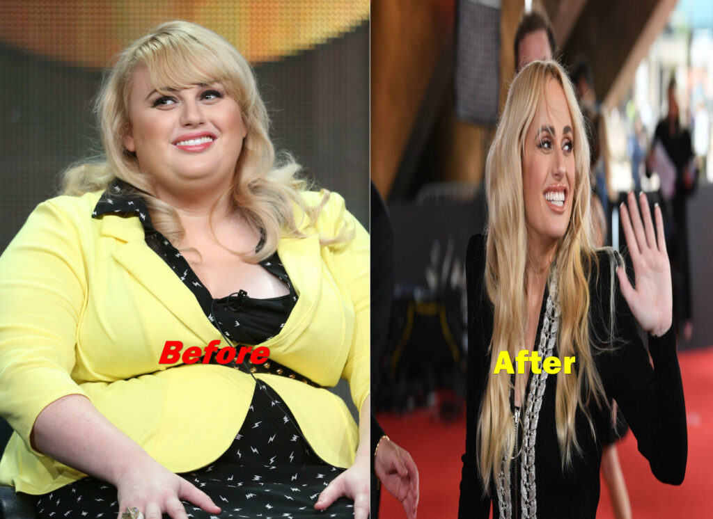 Rebel Wilson Weight Loss Before and After